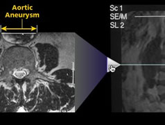 [Interactive MRI Demo]